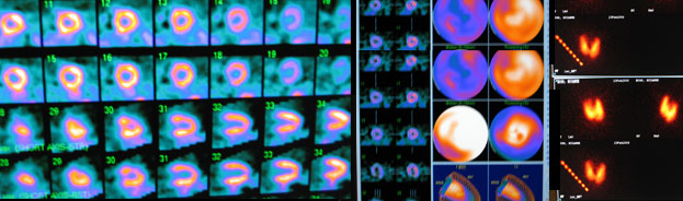 Nuclear Medicine 2